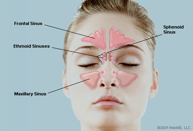 skin sinus